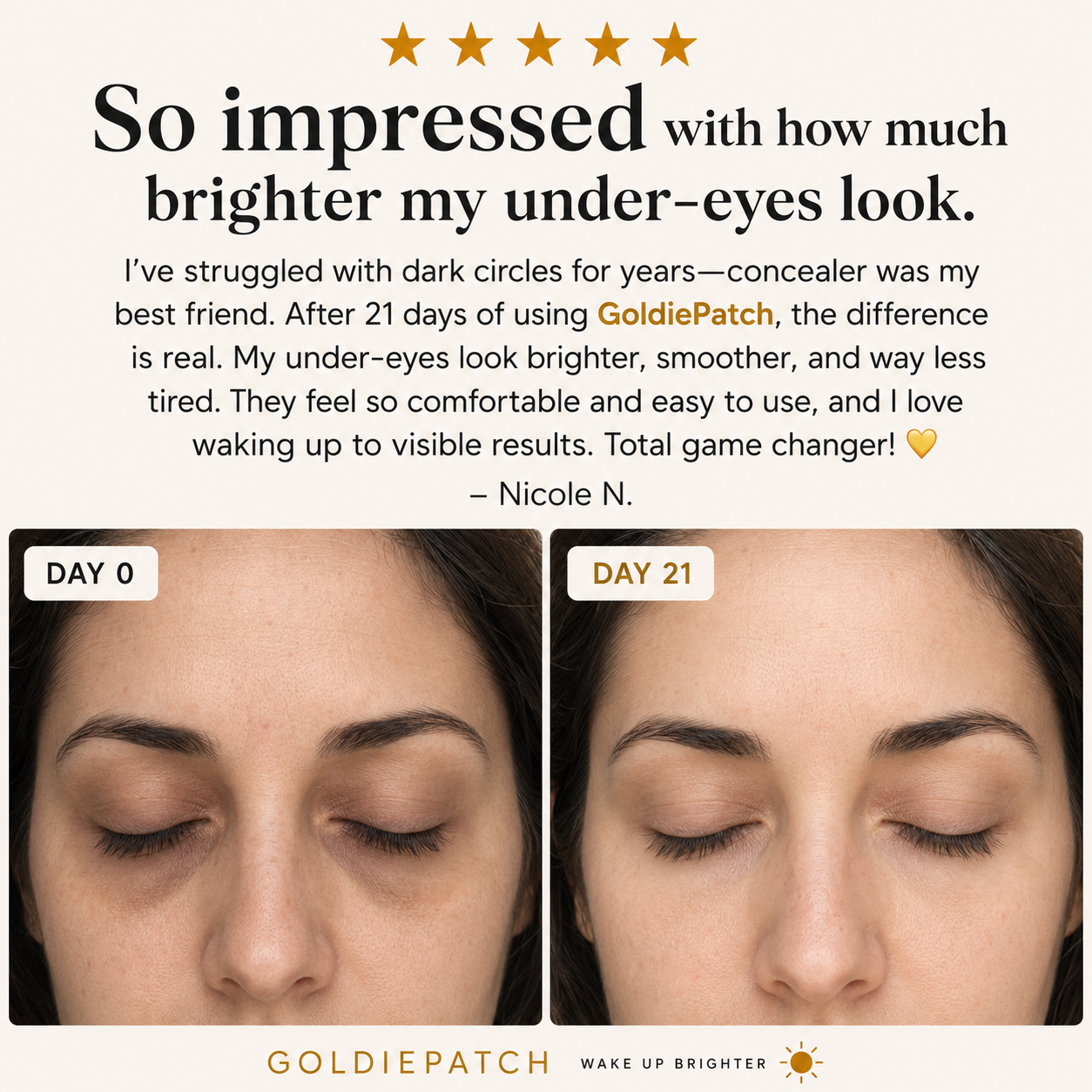 GoldiePatch™